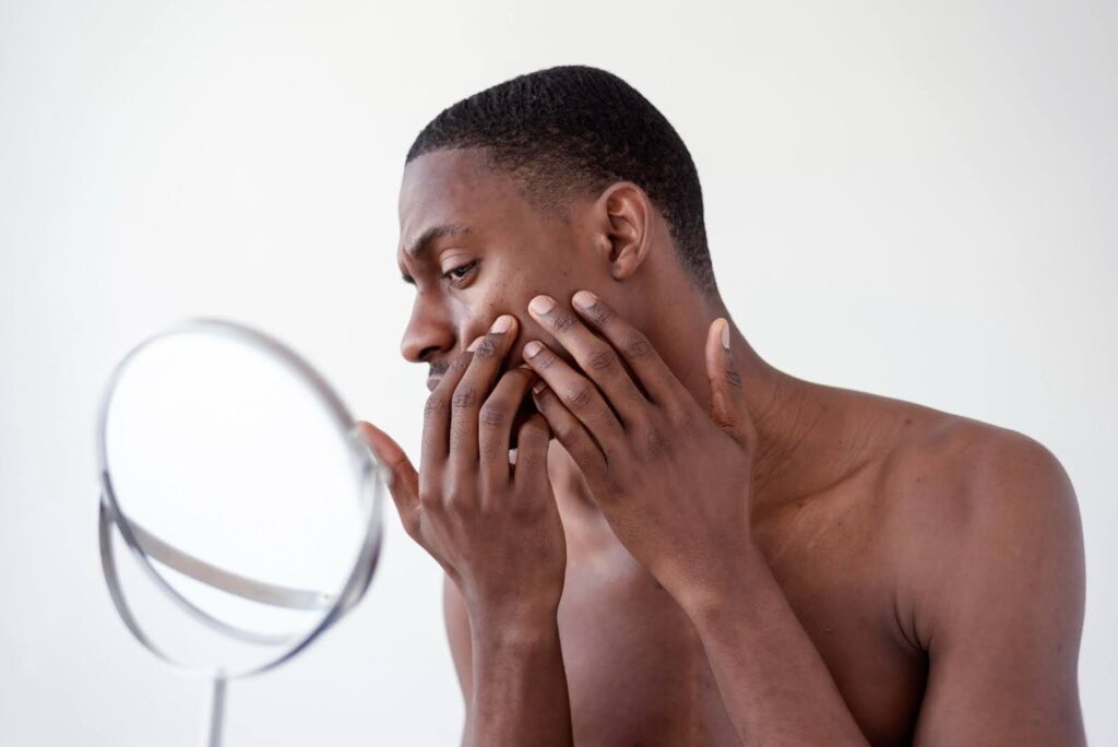 What age does teenage acne go away