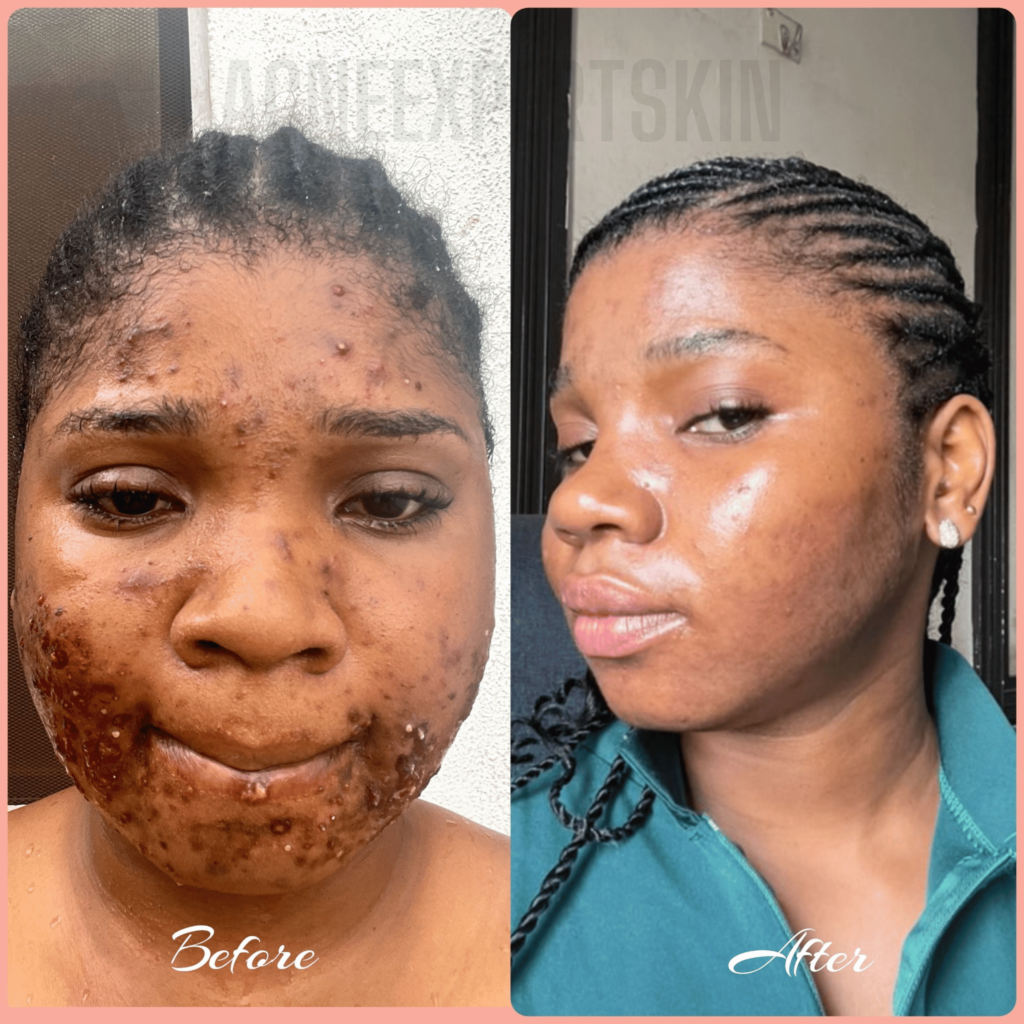 The ADA Transformative Story